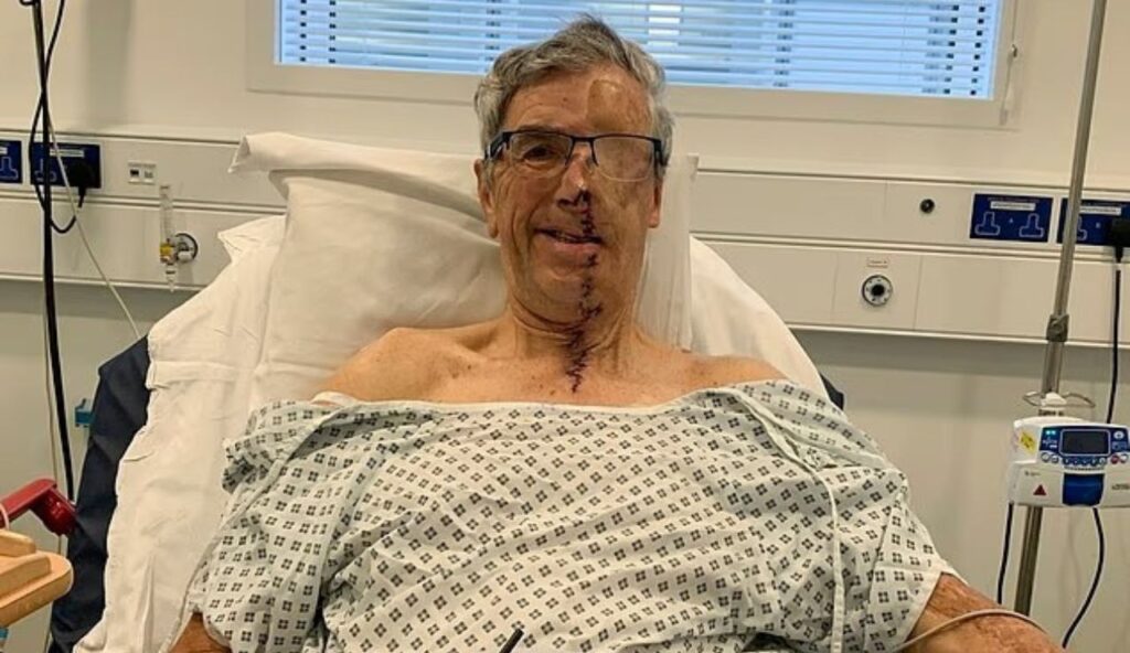 Cyclist Receives Groundbreaking 3D-Printed Facial Prosthetic After Devastating Crash